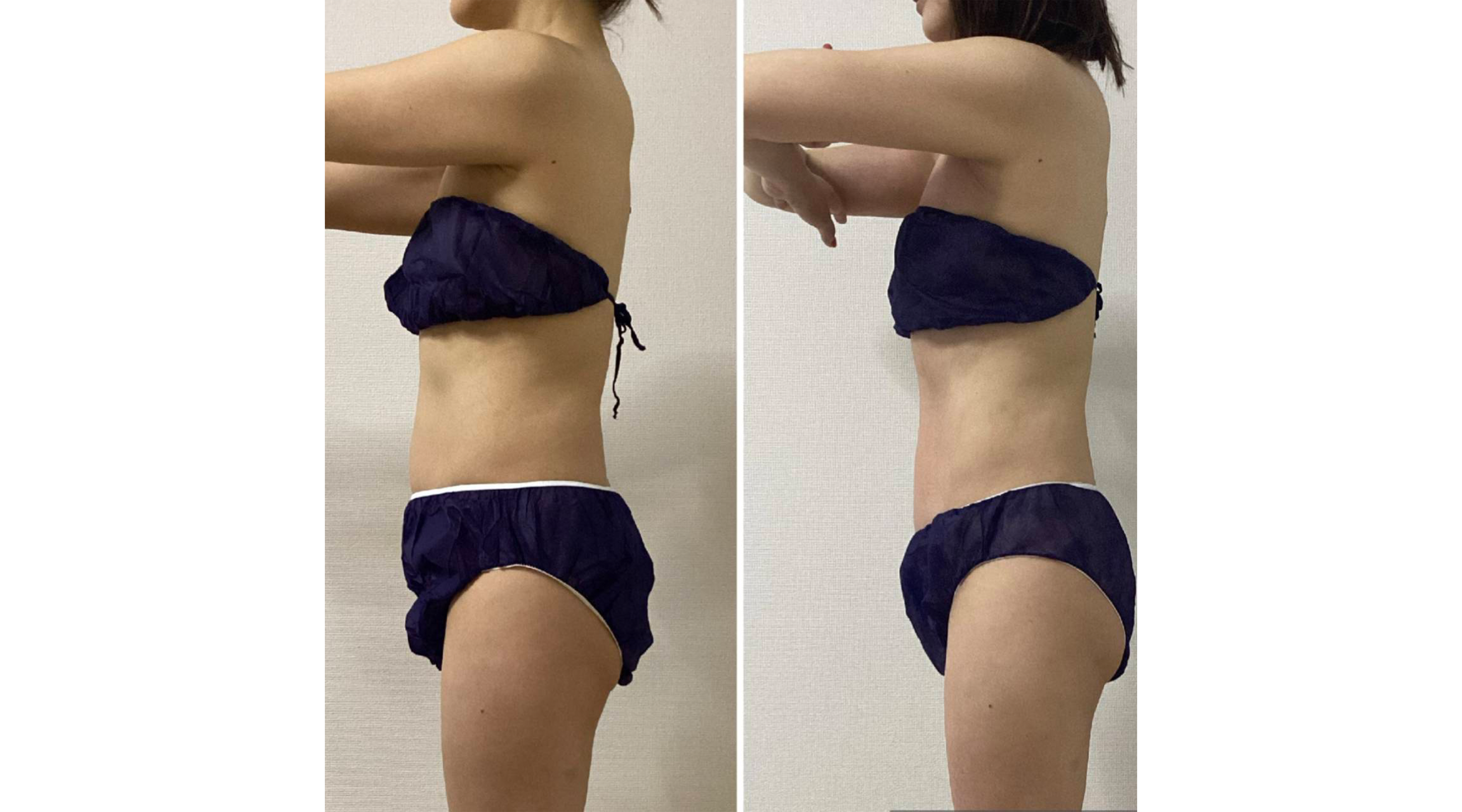 体脂肪、内臓脂肪、筋肉量、代謝も驚きの変化！！